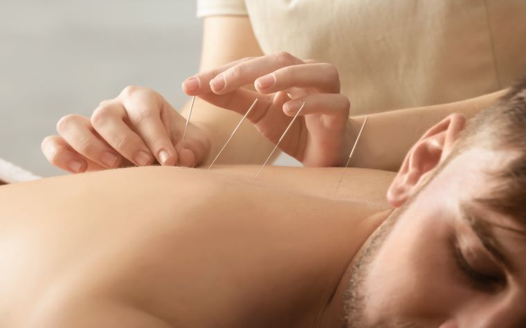 Acupuntura CAL Clínica